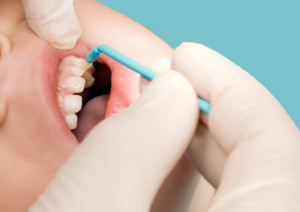 NHS fluoride varnish reforms